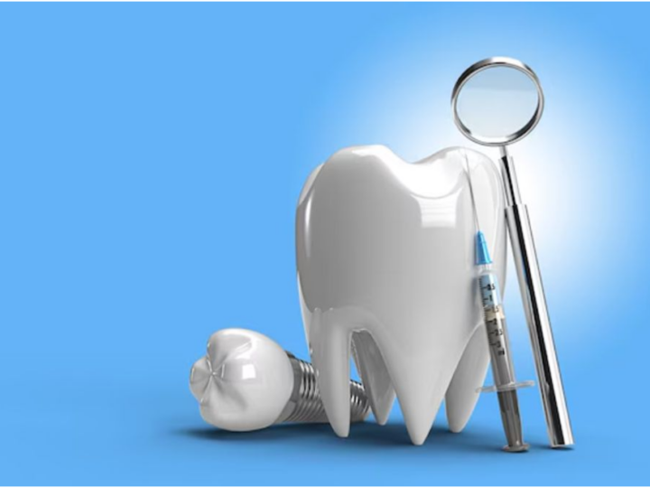 Exploring the Stages of Dental Implant: A New Smile for Your Bright Future